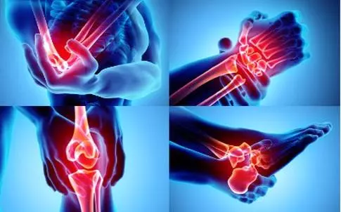 Основные заболевания суставов: как распознать и предотвратить!